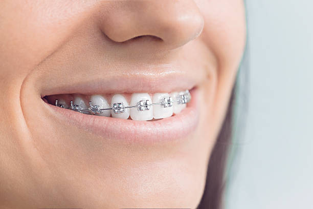 Best Full Mouth Reconstruction  in Stephenville, TX